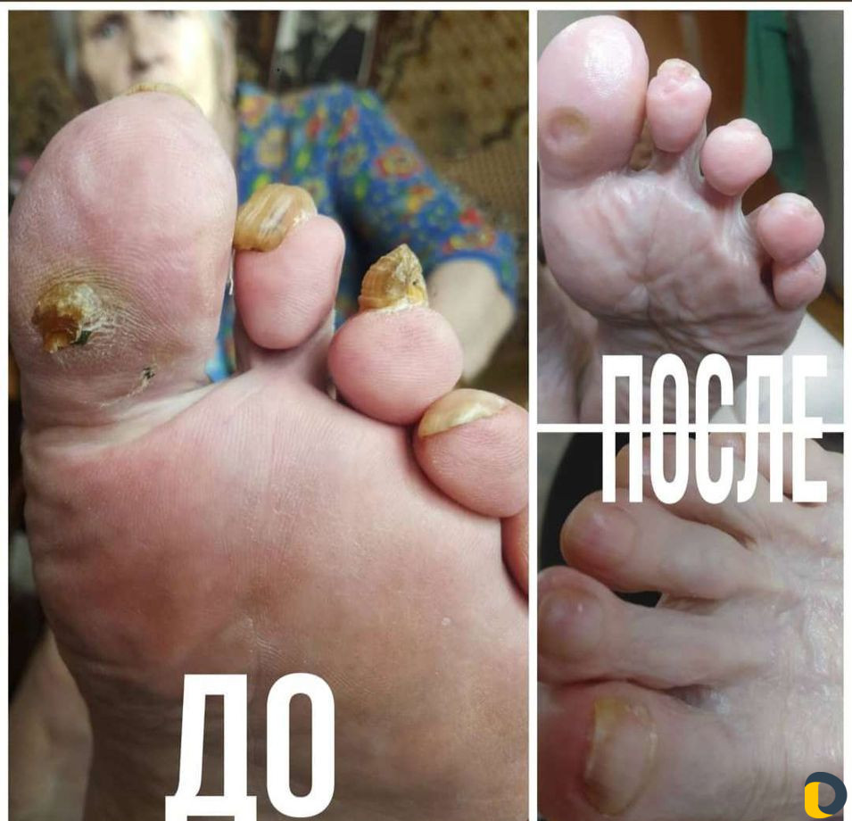 Маникюр, педикюр, наращивание ногтей