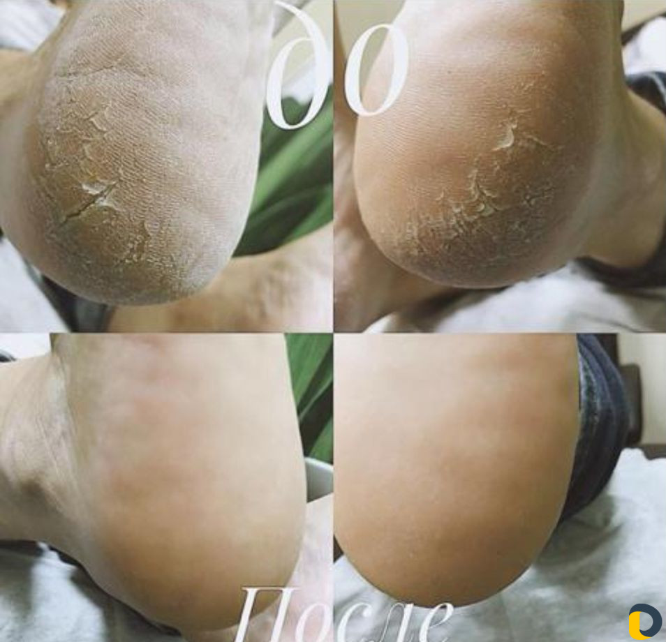 Маникюр шеллак, педикюр,наращивание,дэпиляция,прак