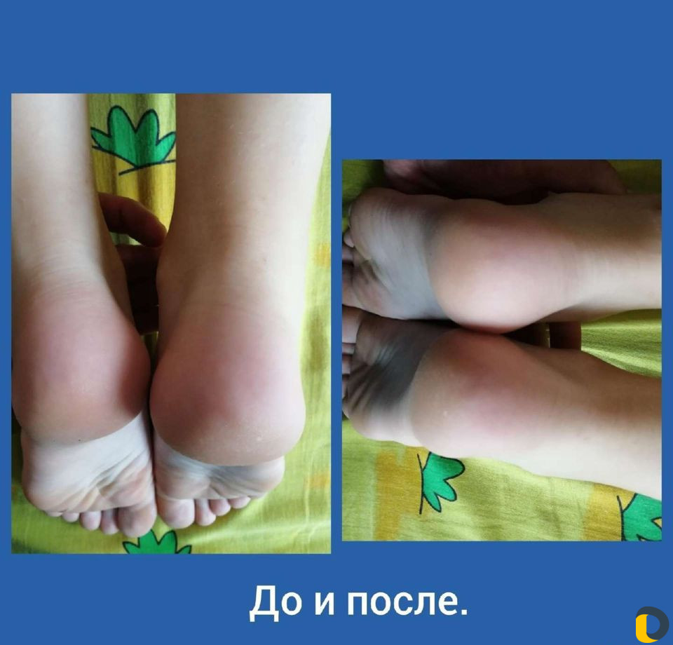 Мануальный массаж