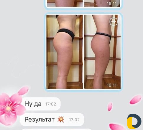 Массаж для женщин(антицеллюлитный,баночный,коррект