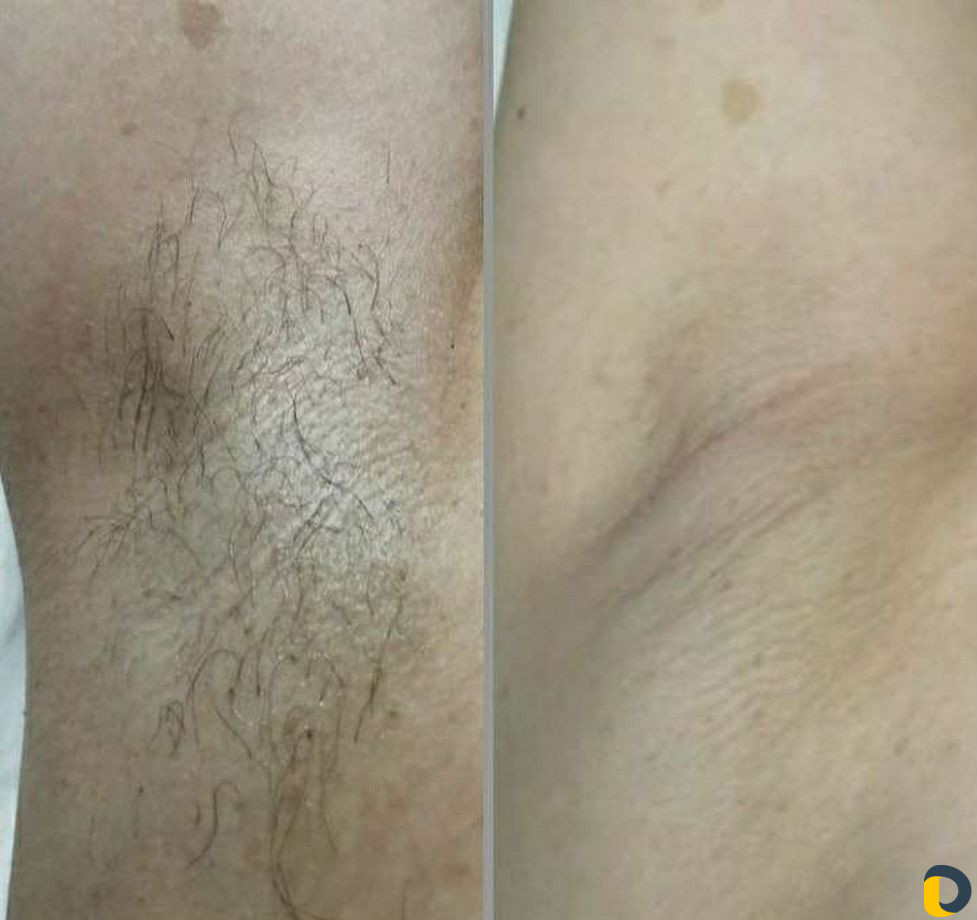 Массаж и шугаринг