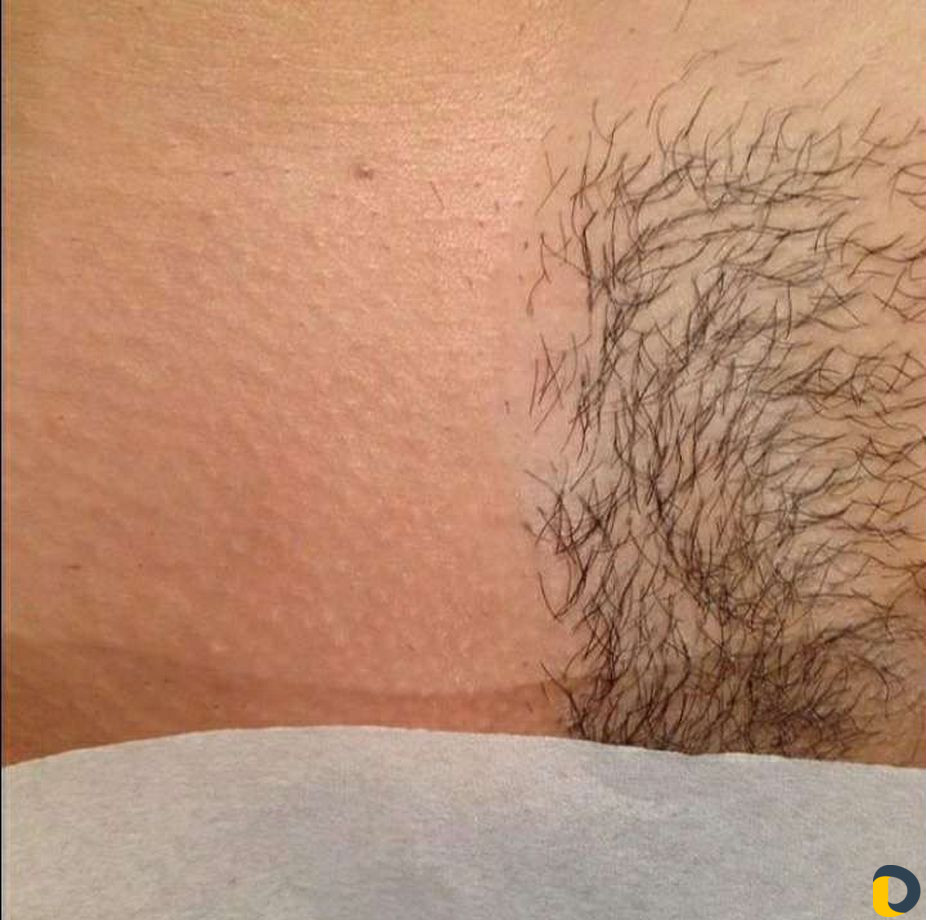 Массаж и шугаринг