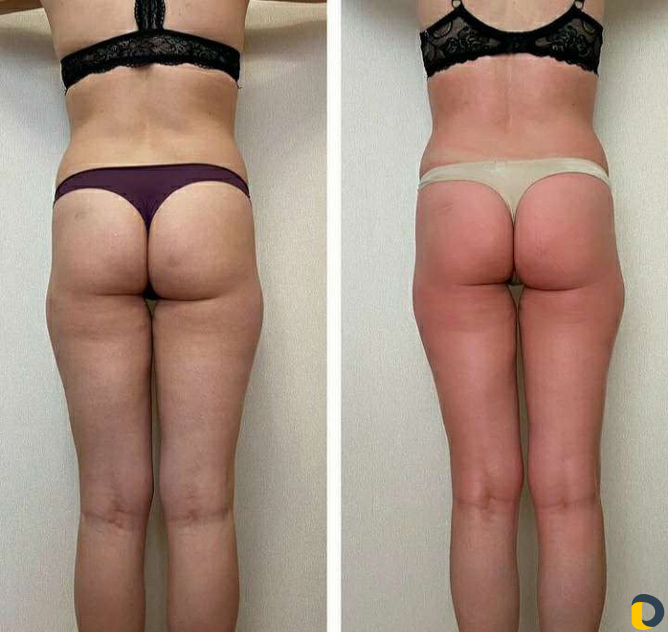 Массаж и шугаринг