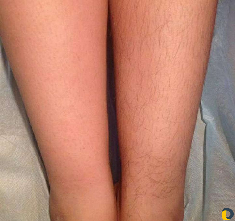 Массаж и шугаринг