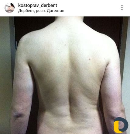 Массаж классический