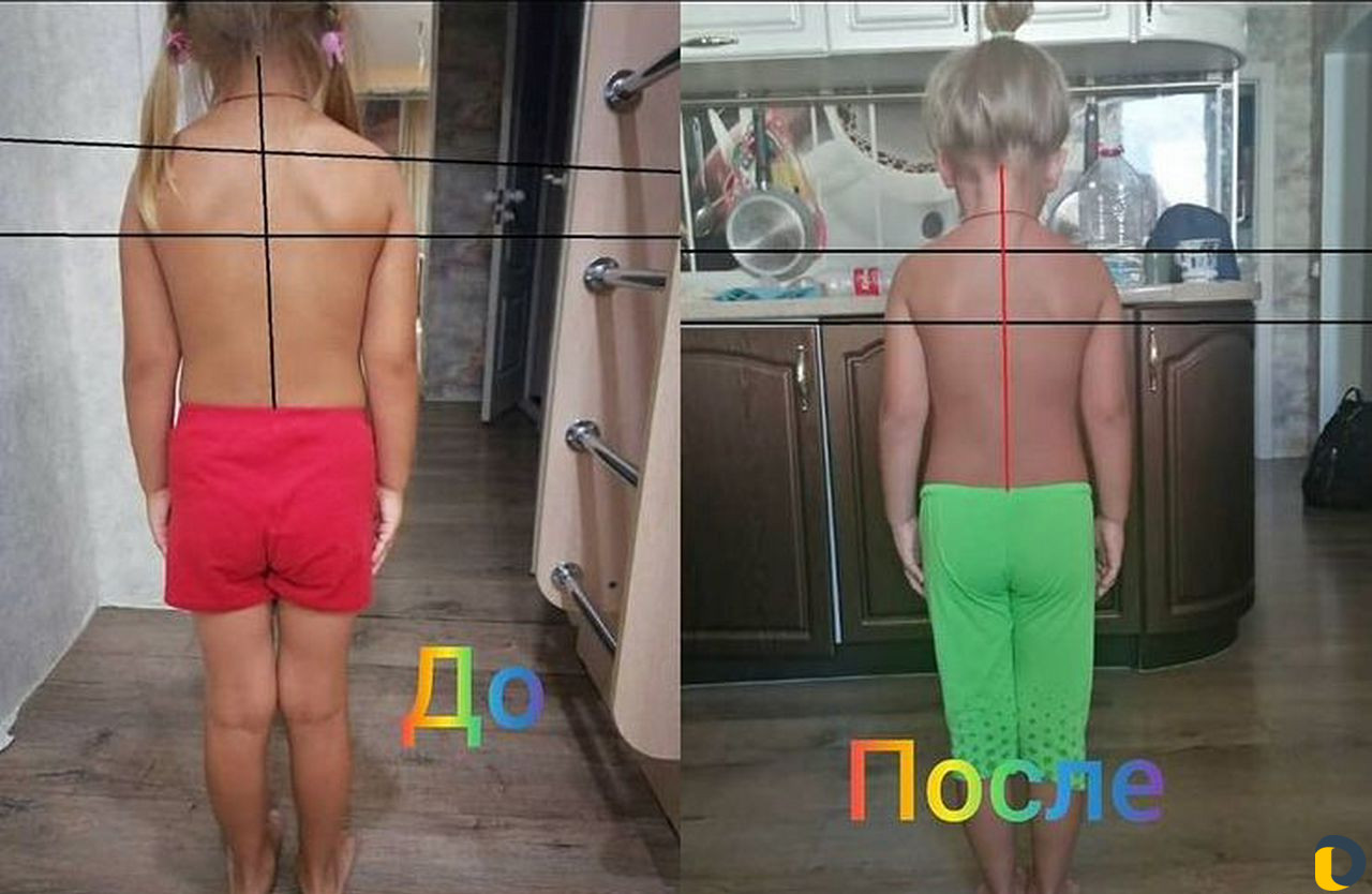 Массаж лфк