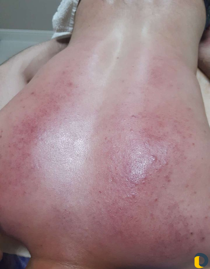 Массаж на выезд