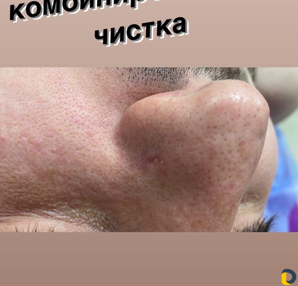 Массаж,обучение,Чистка,Лазер