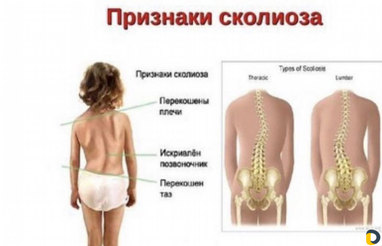 Массаж