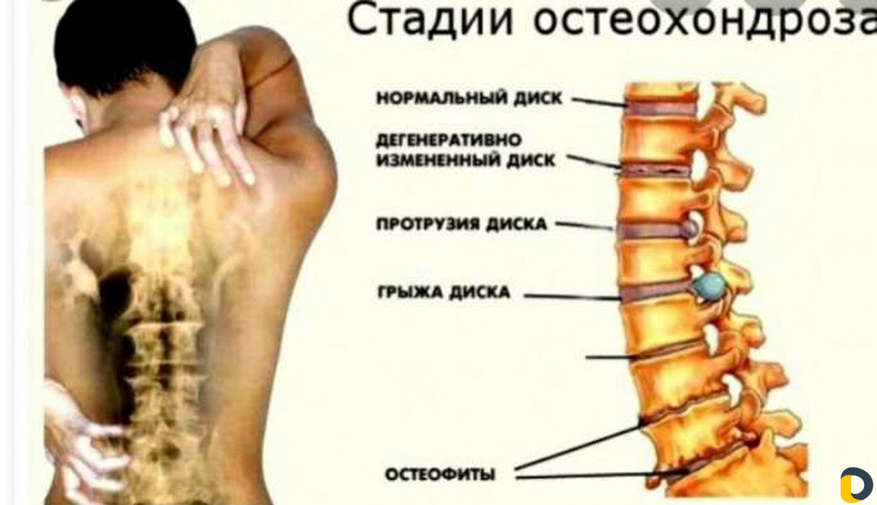 Массаж