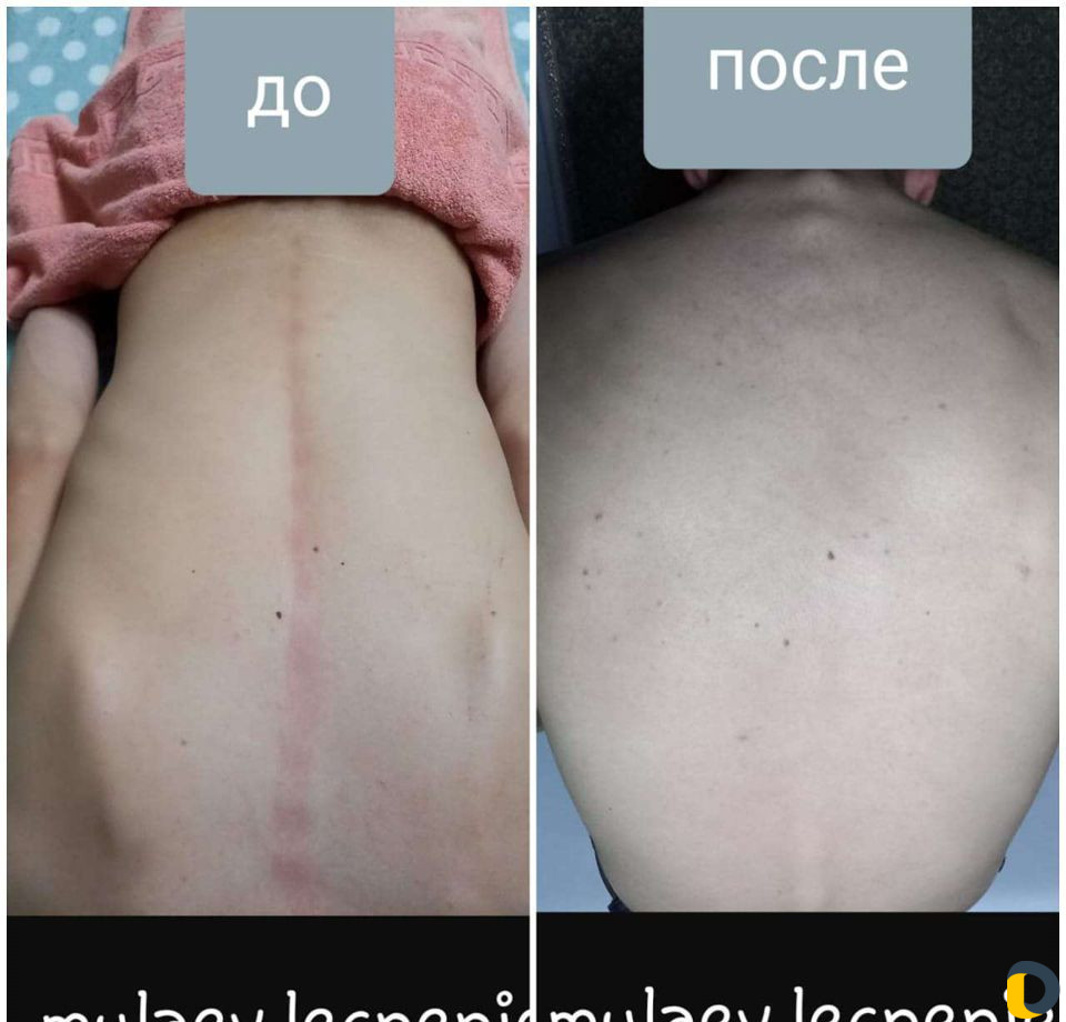 Массаж