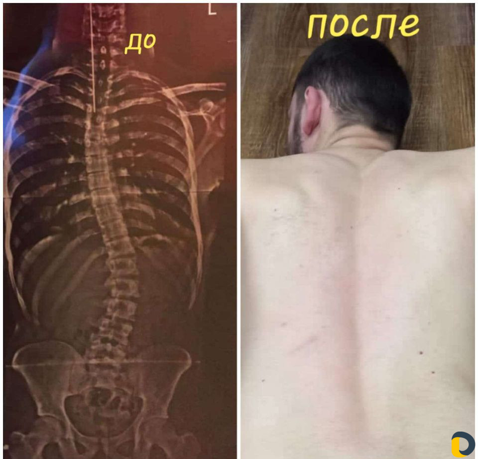 Массаж