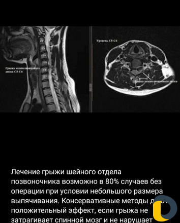 Массаж