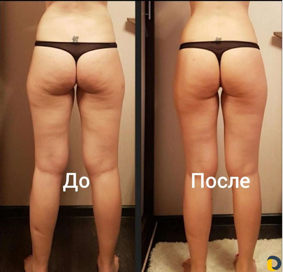 Массаж