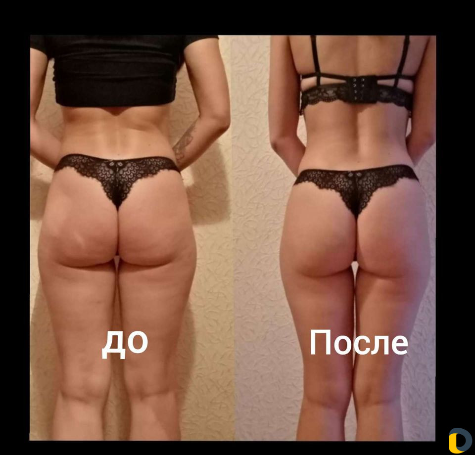 Массаж