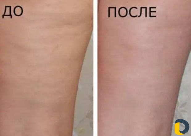 Массаж