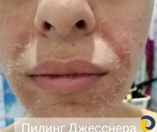 Массаж