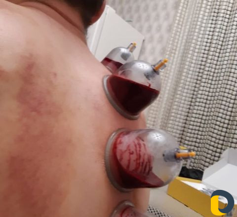 Массаж
