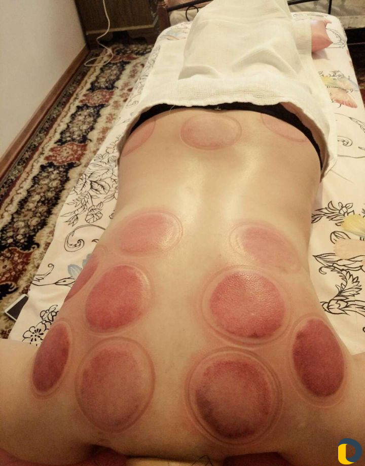 Массаж