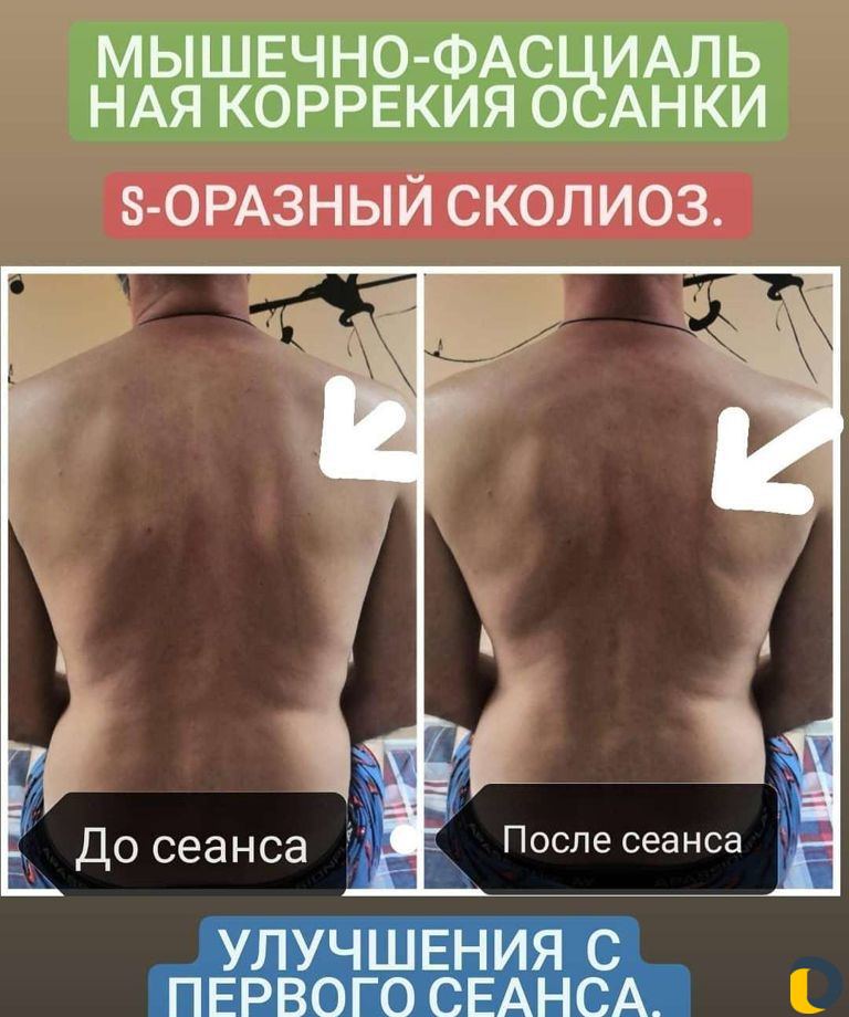 Массаж