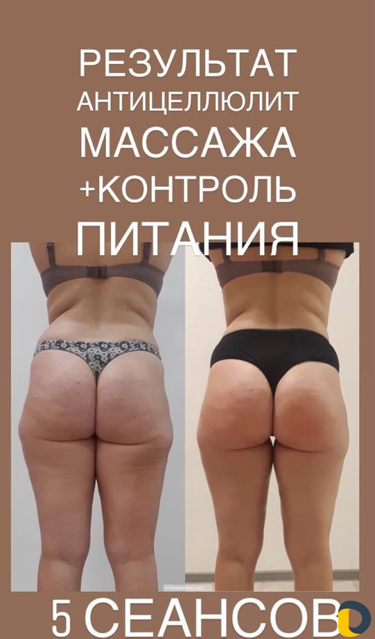 Массажист Приморско-Ахтарск, несколько видов масса