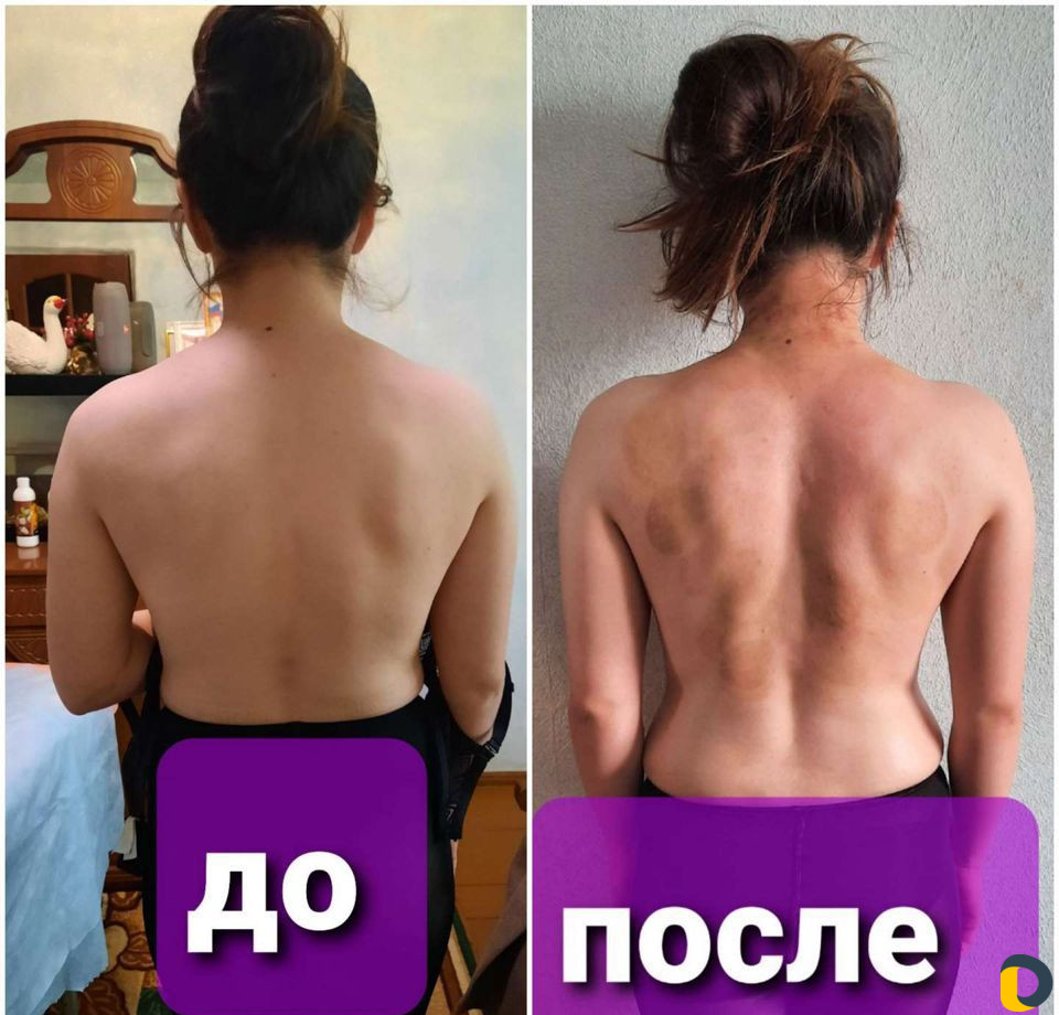 Массажистка с выездом на дом