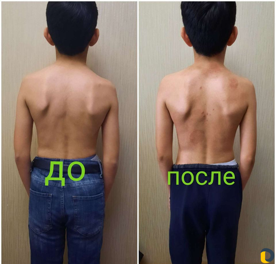 Массажистка с выездом на дом