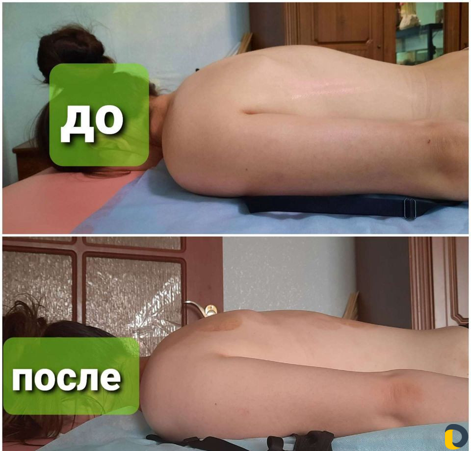 Массажистка с выездом на дом