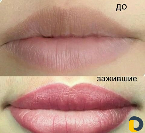 Микроблэдинг и Перманентный макияж