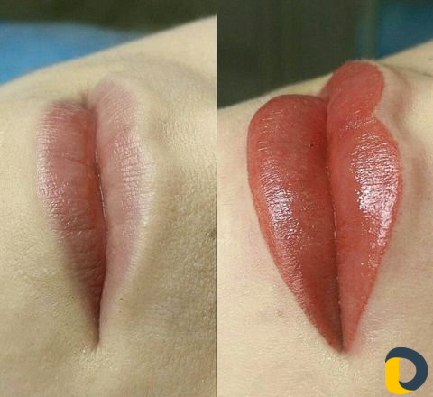 Микроблэдинг и Перманентный макияж