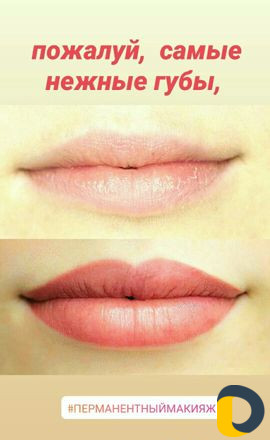 Микроблэдинг и Перманентный макияж