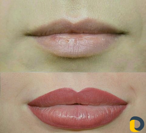 Микроблэдинг и Перманентный макияж