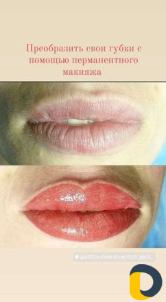 Микроблэдинг и Перманентный макияж