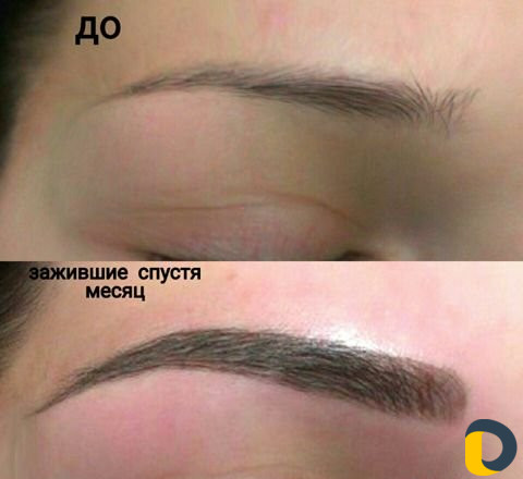Микроблэдинг и Перманентный макияж