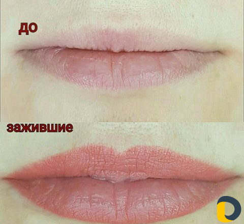 Микроблэдинг и Перманентный макияж