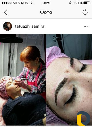 Микроблейдинг