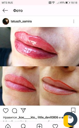 Микроблейдинг