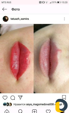 Микроблейдинг