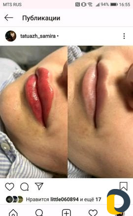 Микроблейдинг