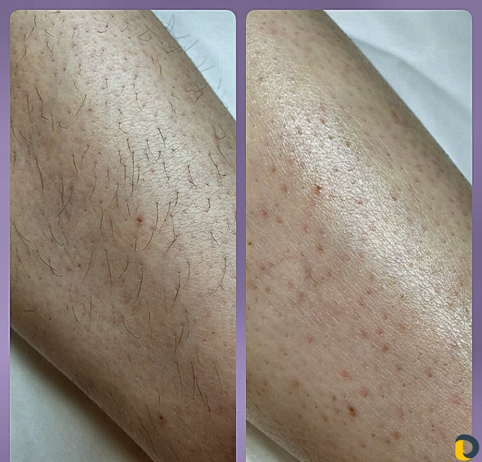 Мужская/женская депиляция. 9-ая Тихая