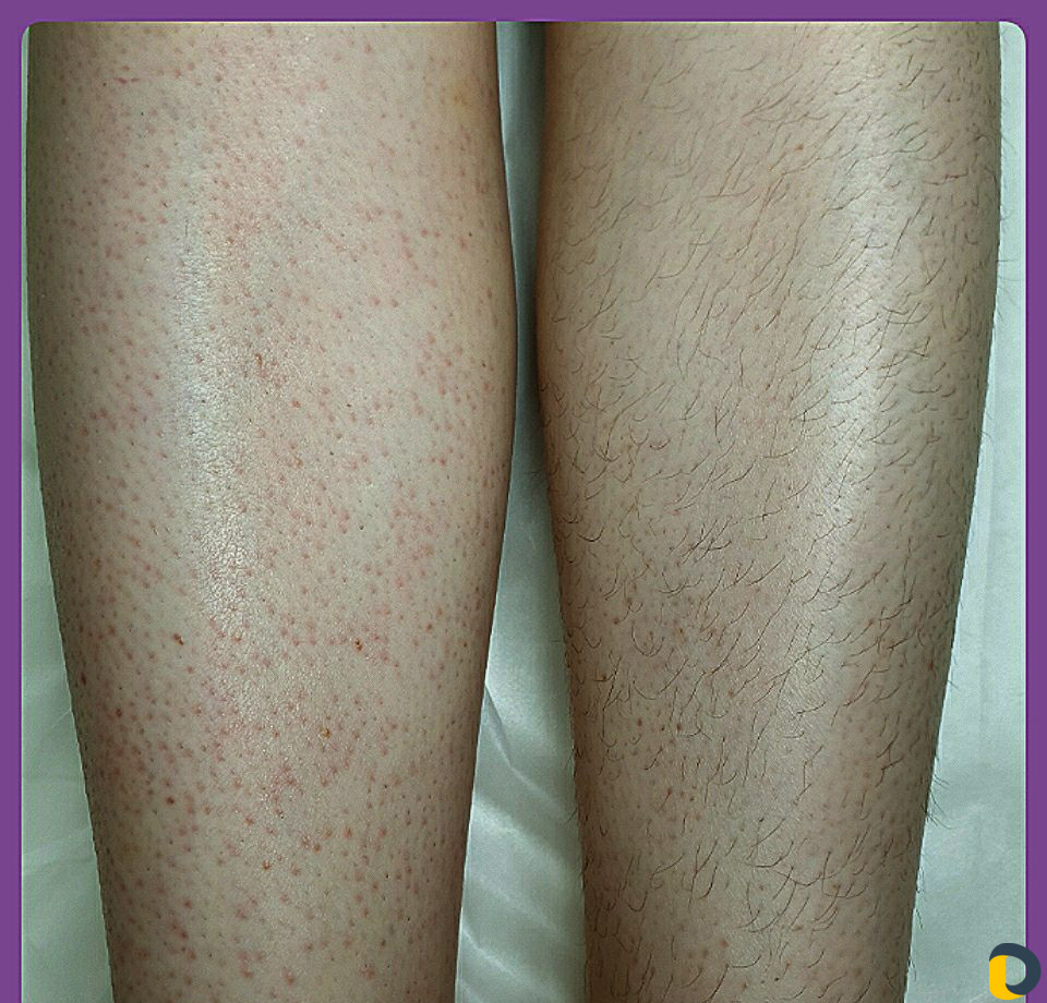 Мужская/женская депиляция. 9-ая Тихая