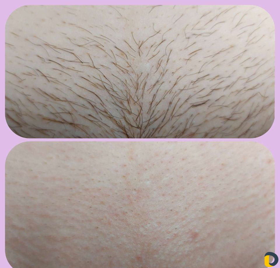 Мужская/женская депиляция. 9-ая Тихая