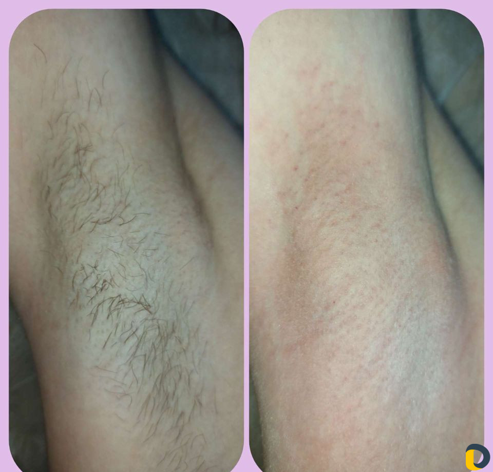 Мужская/женская депиляция. 9-ая Тихая