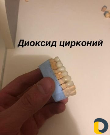 Набор учеников по керамике
