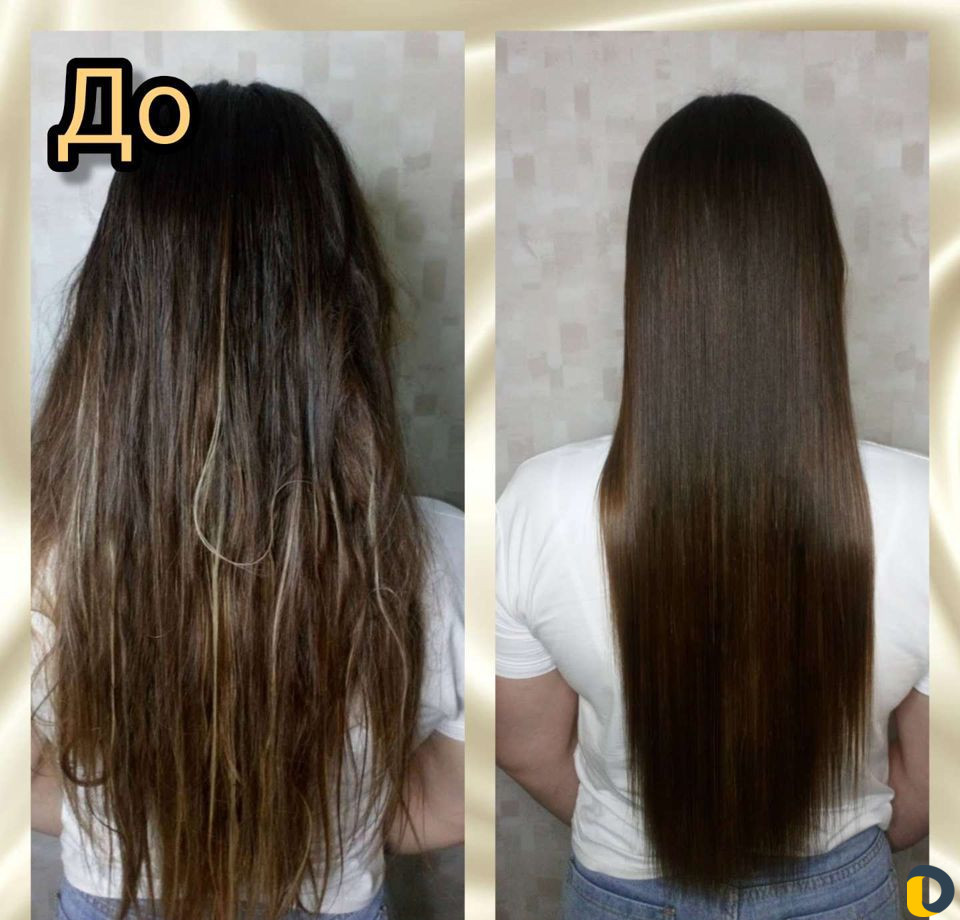 Нанопластика, Ботокс, Кератин