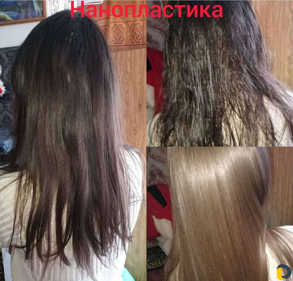 Нанопластика, ботокс, наращивание волос