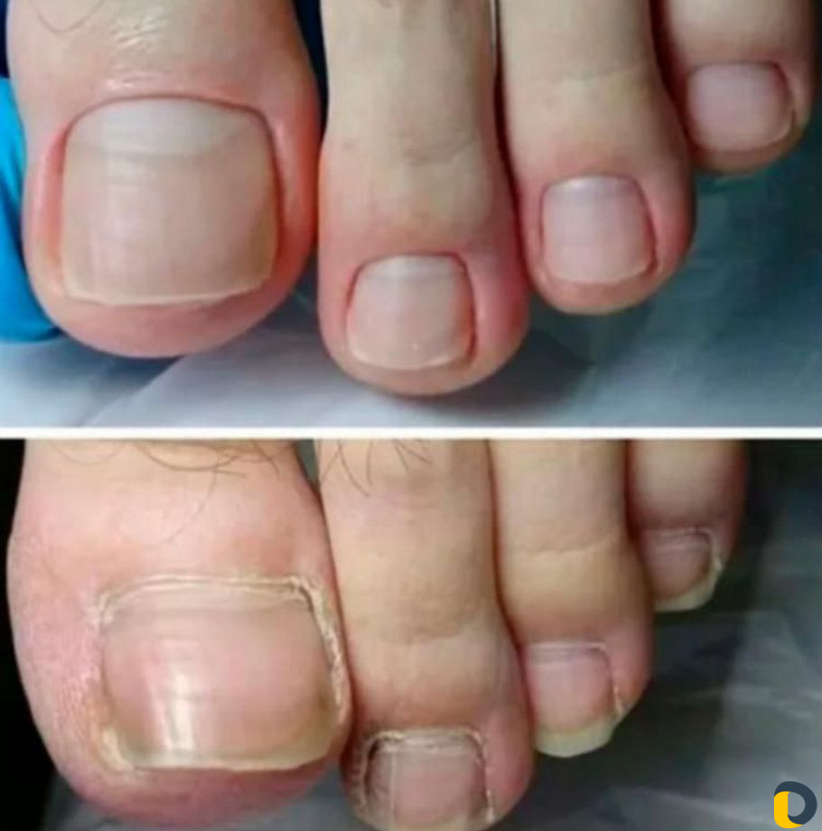 Наращивание ногтей.Педикюр