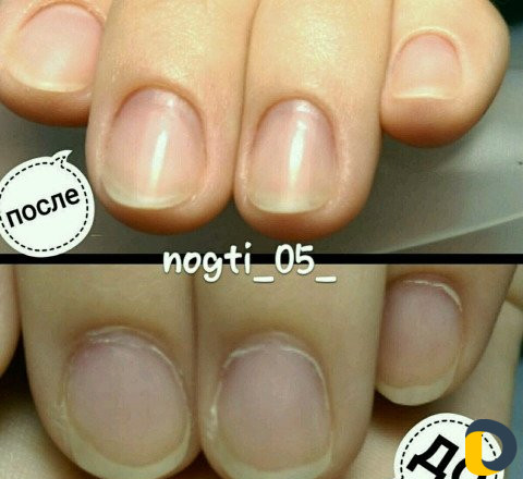 Наращивание ногтей, шеллак