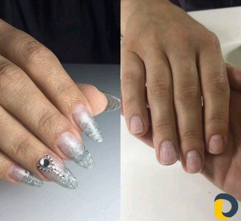 Наращивание