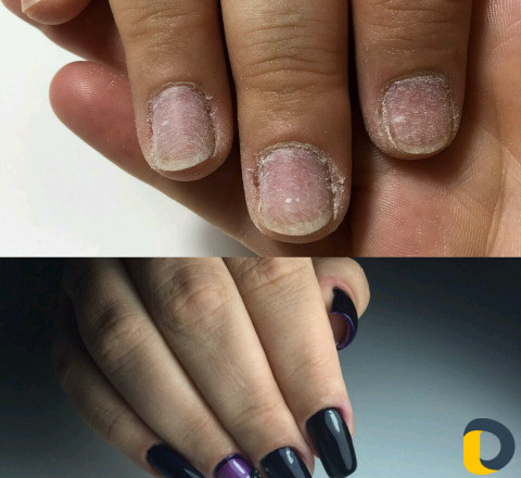 Наращивание